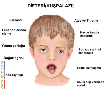 Difteri Nedir?
