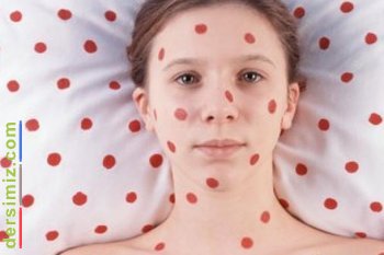 Bulaşıcı Hastalıklar