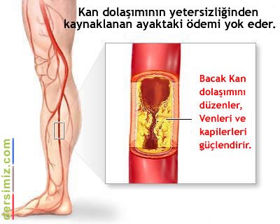 Flebit Nedir?